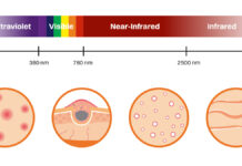 Więcej niż lifting. Technologia NIR w medycynie estetycznej i kosmetologii
