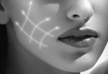 Innari. Technologia bezinwazyjnych „nici” liftingujących prosto z Miami