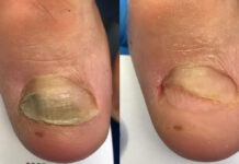 Pałeczka ropy błękitnej