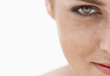 Przebarwienia. Nowe doniesienia naukowe