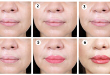 Na drodze do pięknych ust u kobiet z rozszczepem wargi lub podniebienia