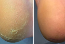 Kiedy naPIĘCIE rośnie