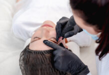 Zabiegi pigmentacji skóry – powikłania oraz skutki niepożądane
