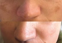 Inhibitory i antyoksydanty modulujące biochemiczne procesy komórkowe oraz blokujące nadmierną produkcję melaniny