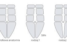 Rozejście mięśnia prostego brzucha u kobiet – to nie takie proste