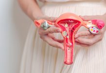 Zespół policystycznych jajników (PCOS) w kontekście trychologicznym