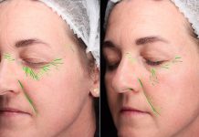 Nowe trendy w suplementacji skóry a zwiększanie efektów zabiegów estetycznych