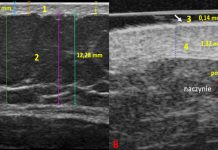 Standardy ultrasonografii w kosmetologii i medycynie estetycznej