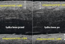 Ocena efektywności preparatu nawilżającego przy wykorzystaniu ultrasonografii o wysokiej częstotliwości
