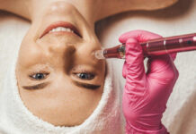 Mezoterapia mikroigłowa w profilaktyce przeciwstarzeniowej oraz odmładzaniu skóry – znaczenie stanu zapalnego, gojenia i regeneracji skóry po zabiegu