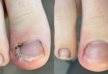 Kobieta w ciąży w gabinecie podologicznym