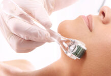 Wpływ zabiegu mezoterapii mikroigłowej na profilaktykę przeciwstarzeniową oraz zmniejszanie objawów starzenia się skóry – subiektywna ocena efektywności zabiegu