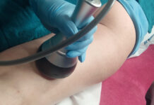 Wpływ liposukcji kawitacyjnej na redukcję tkanki tłuszczowej. Opis przypadku