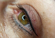 Aspekty techniczne makijażu permanentnego. Cz. 3. Pigmentacja powiek