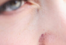 Osoby wysoko wrażliwe – kiedy „dzielisz włos na czworo”