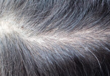 Starzenie się skóry głowy a wypadanie włosów
