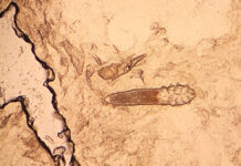 Nużeniec a oporność skóry na terapię kosmetologiczną