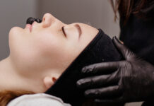 Akupunktura kosmetyczna