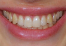 Planowanie uśmiechu. Aspekty funkcjonalne i estetyczne we współczesnej stomatologii estetycznej