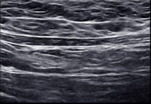 Ultrasonografia. Nowoczesne narzędzie podnoszące bezpieczeństwo w zabiegach estetycznych