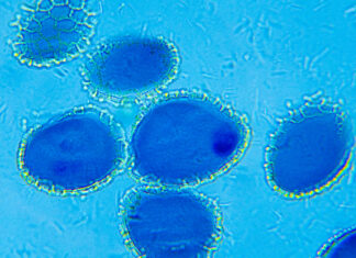 Etosomy jako alternatywne systemy nośnikowe substancji aktywnych w kosmetykach