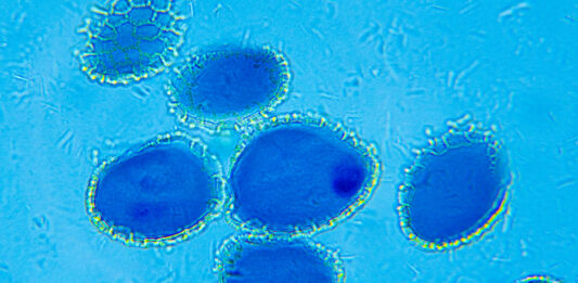 Etosomy jako alternatywne systemy nośnikowe substancji aktywnych w kosmetykach