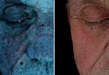 Multispektralne obrazowanie skóry to już standard. Czas na diagnostykę łączoną