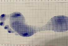 Styl życia a zmiany w obrębie stóp i kończyn dolnych. Cz. I. Diagnostyka i wczesne wykrywanie zmian